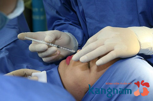 nang-mui-co-dat-khong 1