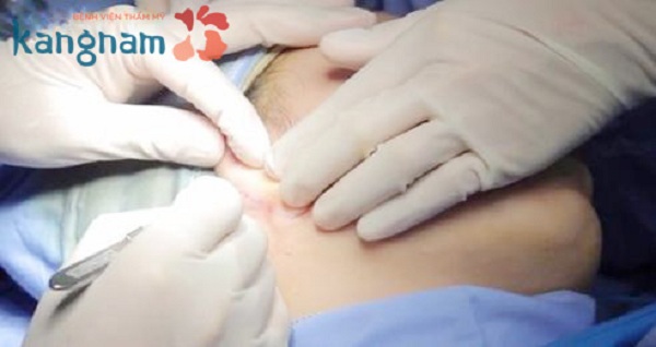 nang-mui-co-may-loai 8