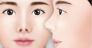 mũi hếch tướng số