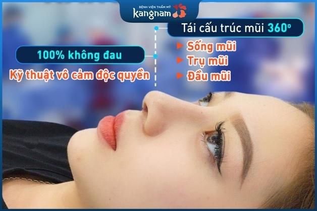 Nâng mũi 6D Surgiform giá bao nhiêu? Bật mí địa chỉ uy tín