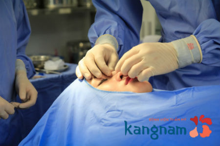 phẫu thuật nâng mũi mất bao lâu 1