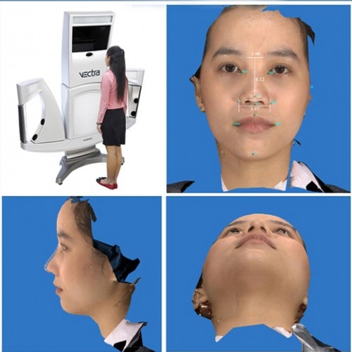 may-vectra-3D-nang-mui